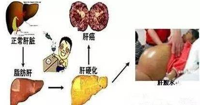 乙肝的最新治疗方法,乙肝的最新治疗方法，曙光初现的希望之光，乙肝最新治疗方法，曙光初现的希望之光