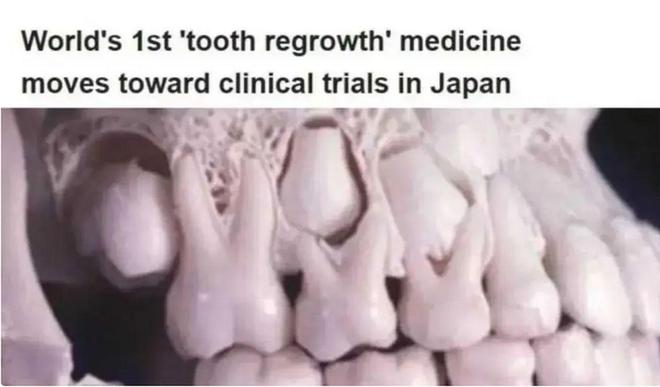 再生牙最新消息,再生牙研究的最新消息，突破与未来的希望，再生牙研究获突破，最新进展揭示未来希望